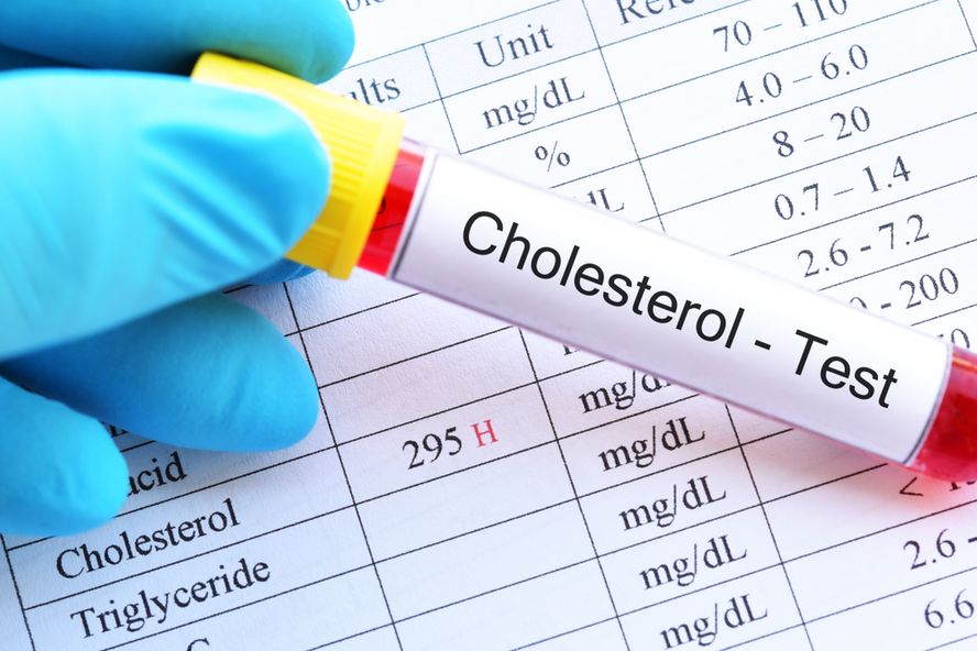 Common Myths and Misconceptions About Cholesterol