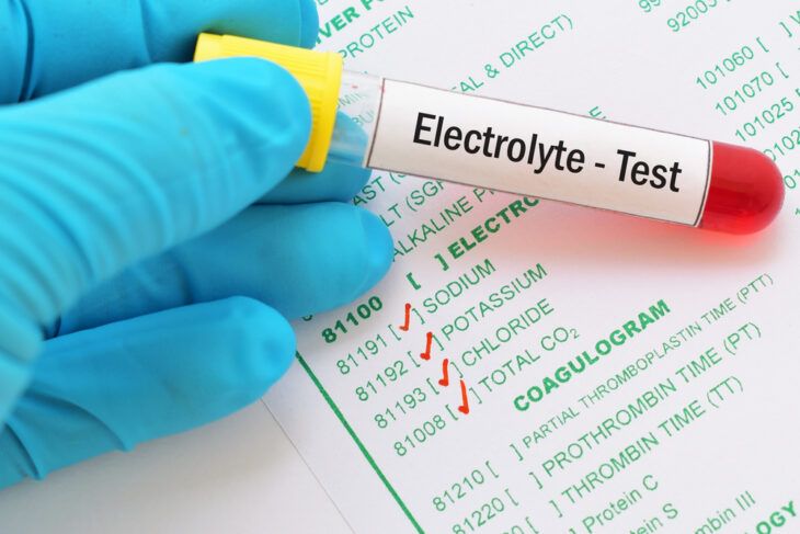 Electrolyte blood test