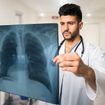 Breathe In These Facts About Pulmonary Fibrosis