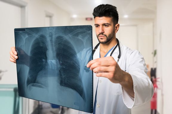 Atmen Sie diese Fakten über Lungenfibrose ein
