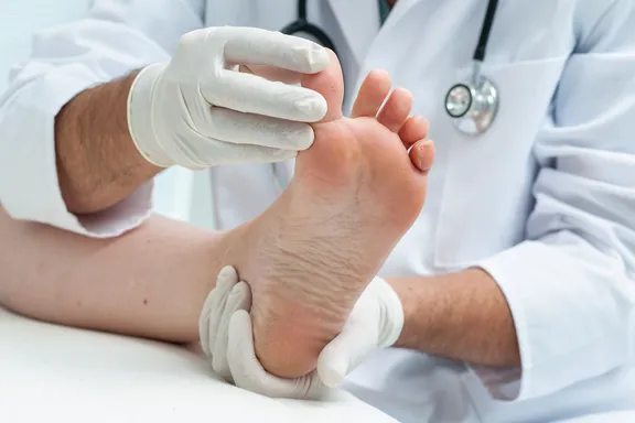 Important Facts to Know About Gout