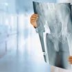 Hip Replacement Surgery: Purpose, Preparation, and Recovery