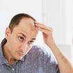 Male Pattern Baldness: Signs, Causes, and Treatments