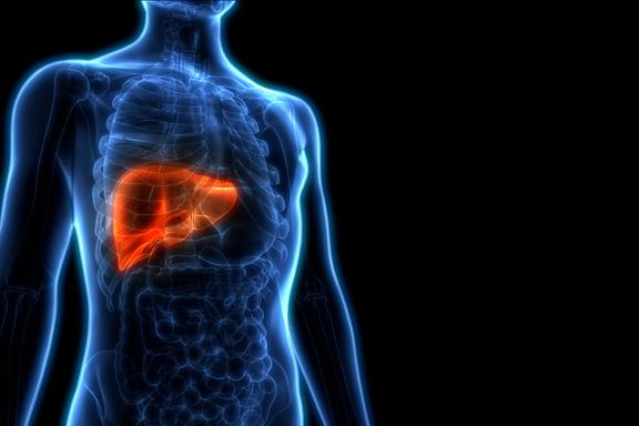 Uncovering The Genetic Causes of Fatty Liver Disease - A Growing Health Concern