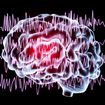 Silent, Subtle and Unseen: How Seizures Happen and Why They’re Hard to Diagnose